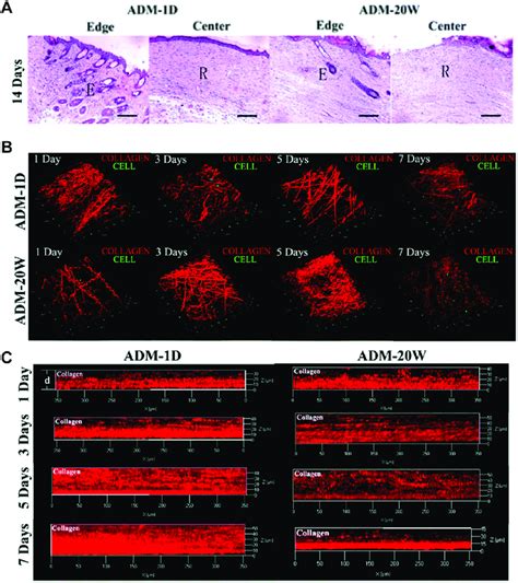Image result for Dermal Matrix Application