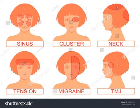 [DIAGRAM] Migraine Headache Diagram - WIRINGSCHEMA.COM