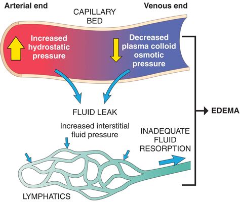 Hemodynamic Disorders, Thromboembolism, and Shock - Clinical Tree
