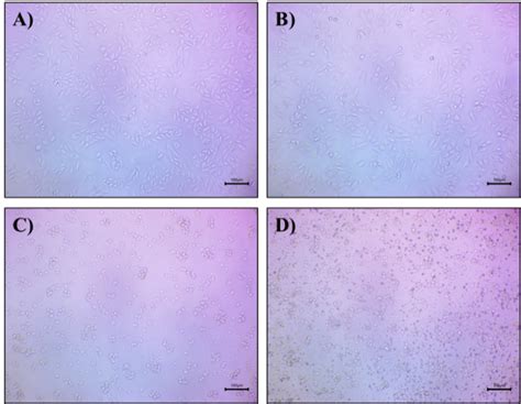 Fig. 12: Microscopic images of MCF-7 cells treated with nanoemulsion ...