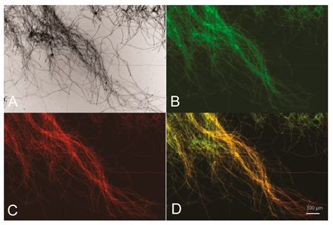 Identification of a Bidirectional Promoter from Trichoderma reesei and ...