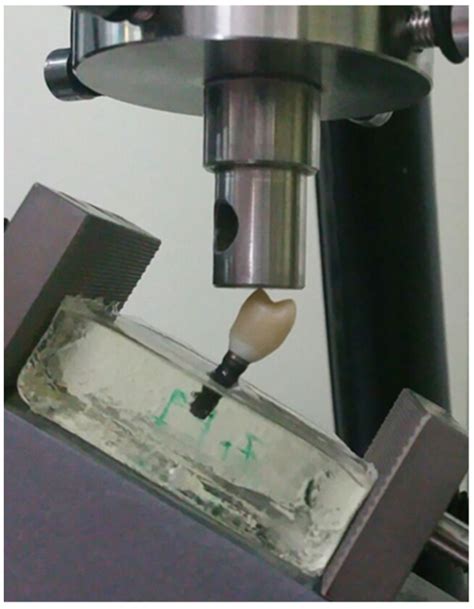 Mechanical Performance of Chairside Ceramic CAD/CAM Restorations and ...