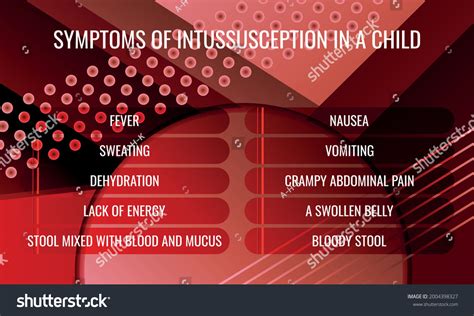 Image result for Intussusception Symptoms