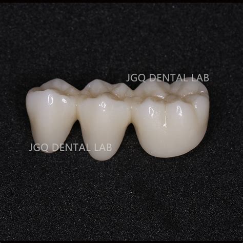 Import NM-A7133 Multi-Unit Abutment, 30° Angle, H2.0, Titanium Dental ...