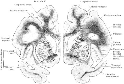 Coronal Sections of the Cerebral Hemispheres | ClipArt ETC