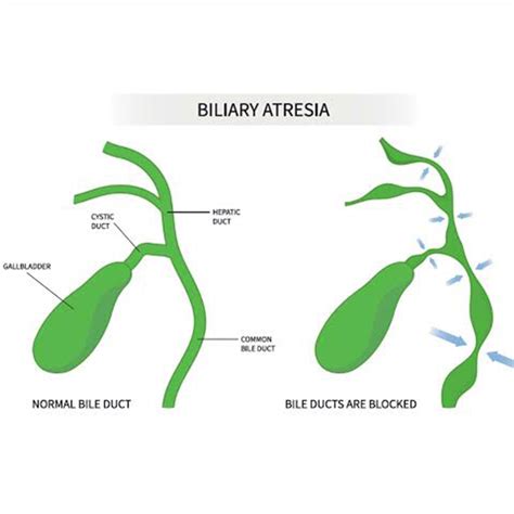 Paediatric DayCare Surgeries in Tambaram | Day Care Paediatric ...