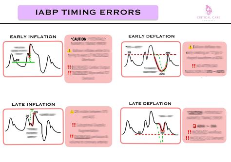 Image result for IB/AP Correct Timing