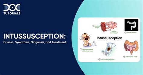 Image result for Intussusception Symptoms