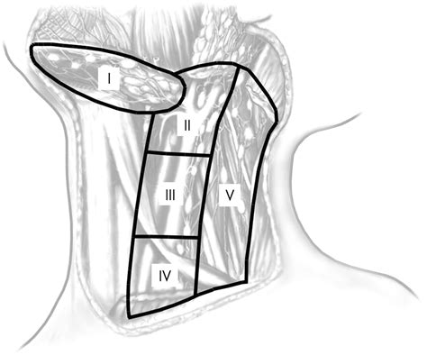Complex head and neck specimens and neck dissections. How to handle them | Journal of Clinical ...