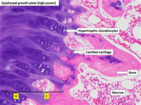 Bone Development Algorithm 的图像结果