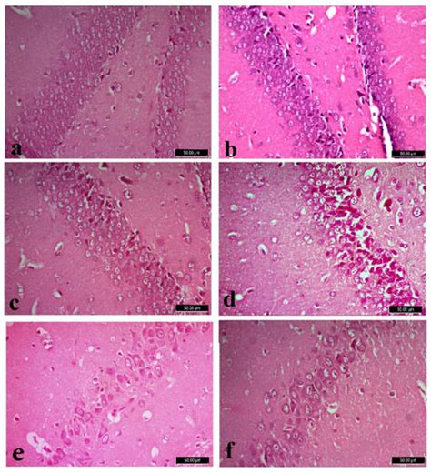 Correction: Mahmoud et al. Neurotoxic Effect of Fipronil in Male Wistar ...