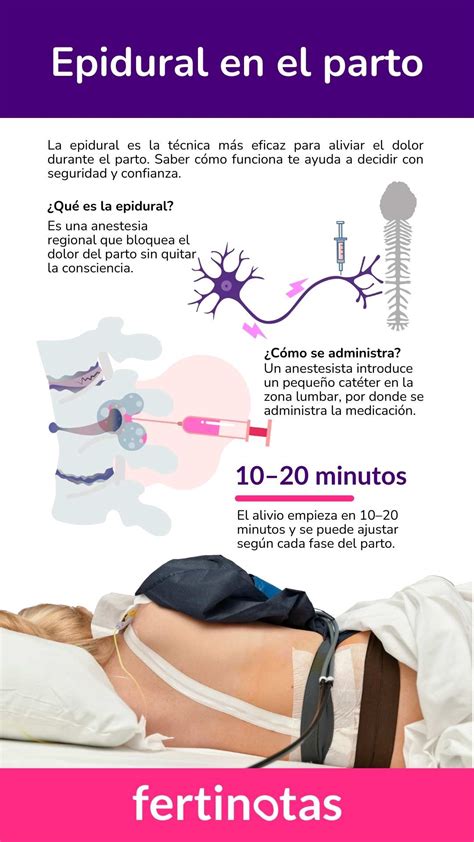 ¿Parto con o sin epidural? Lo que debes saber para decidir - Fertinotas