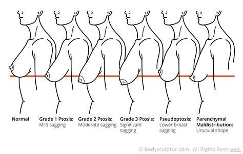 Виды груди фото