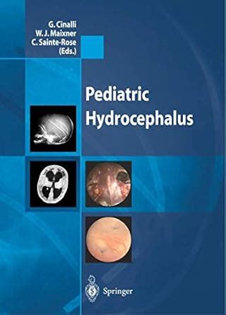 Buy Pediatric Hydrocephalus Book Online at Low Prices in India ...