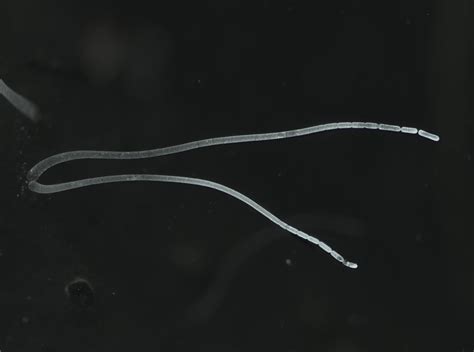 Video of the world's biggest bacteria species | Popular Science