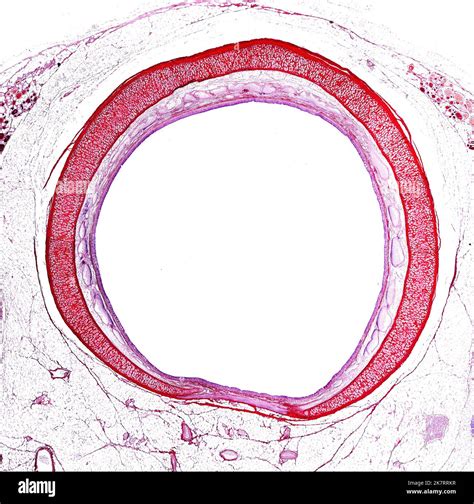 Light micrograph of a cross-section of the trachea, showing C-shaped ...