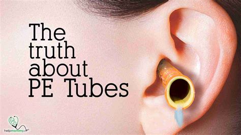 The Truth About Pressure Equalization Tubes | HelpMommy