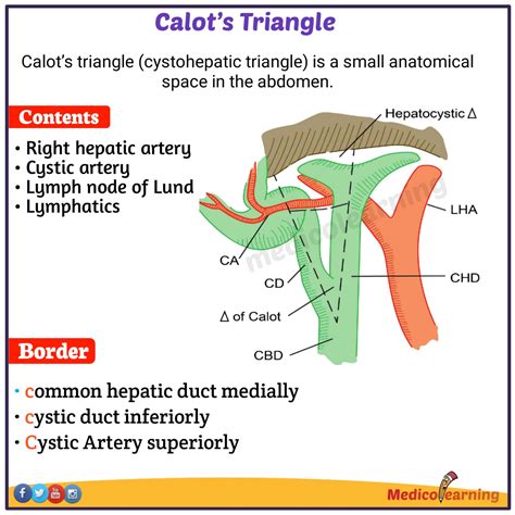 Calot's triangle boundaries Mnemonic - MedicoLearning