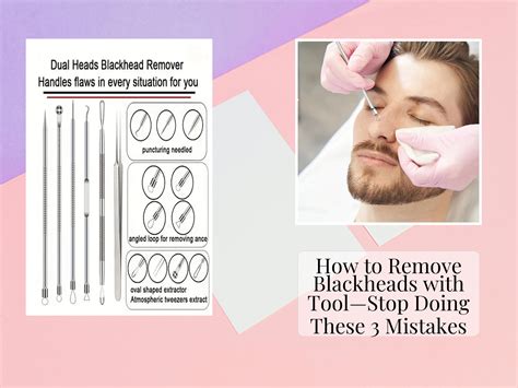 How to Remove Blackheads with Tool—Stop Doing These 3 Mistakes - KentDO ...