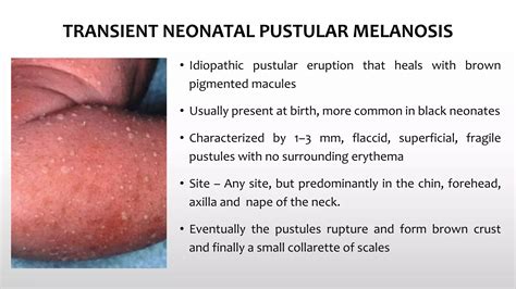Common skin conditions in neonates | PPTX