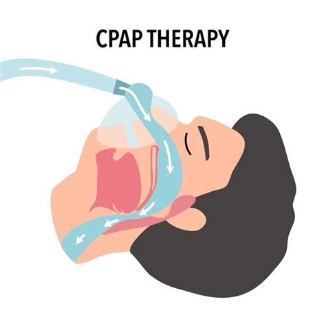Image result for CPAP and BiPAP Machine Drawing