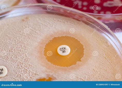 Image result for Disk Diffusion Method Procedure