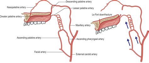 Cleft and craniofacial orthognathic surgery - Clinical Tree