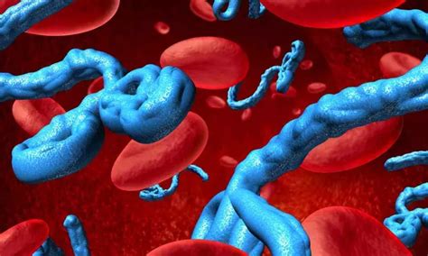 Infection prevention and control for Ebola and Marburg disease: WHO ...