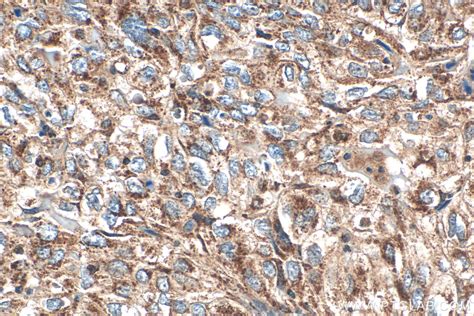 MTHFD2 antibody (68524-1-Ig) | Proteintech
