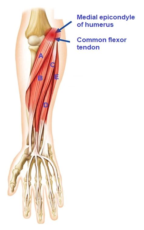 Medial Epicondyle Of Humerus Pain