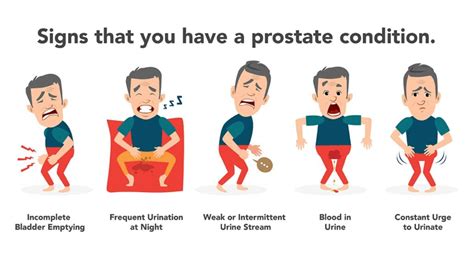 Prostate Cancer in young males - Medically Speaking