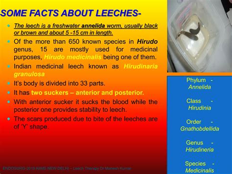 Leech and Leech therapy :scientific overview and its application | PDF