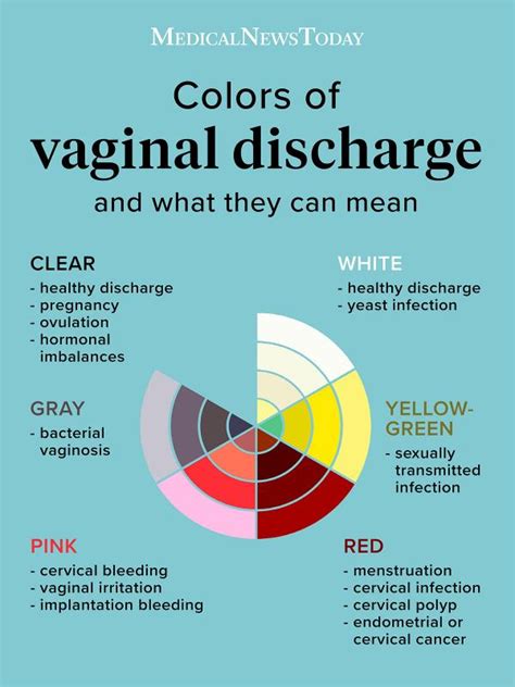 Vaginal discharge color guide: What to know