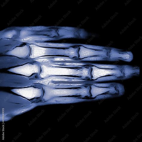Image result for High-Resolution Hand MRI