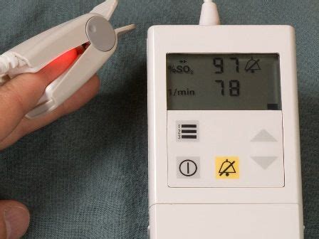 Normal SpO2 Chart 的图像结果