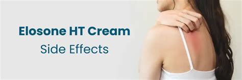 Elosone HT Cream Side Effects - Medicover
