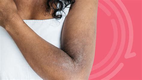 Image result for Human Defence Line Skin