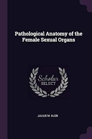Pathological Anatomy of the Female Sexual Organs : Klob, Julius M ...