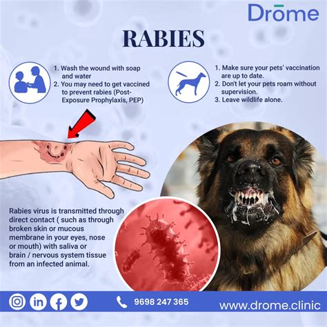 Rabies Bite Rabies: A Comprehensive Overview, For Vaccination Call