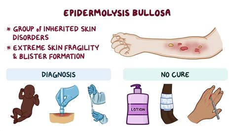 Epidermolysis Bullosa Age Expectancy