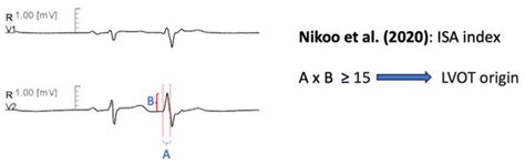 Electrocardiographic Characteristics, Identification, and Management of ...