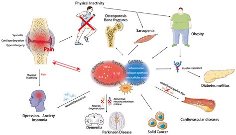 Frontiers | Exploration beyond osteoarthritis: the association and mechanism of its related ...