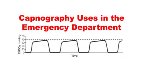 Waveform Capnography Tracheal Intubation at Dale Mack blog