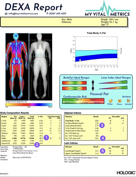 Image result for Dexa Scan Interpretation
