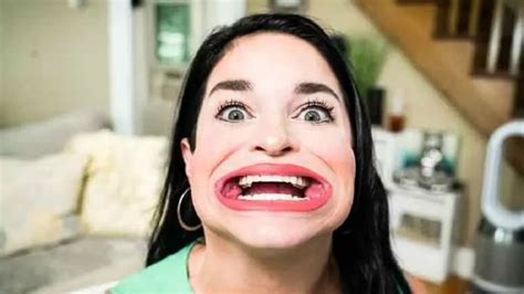 Largest Female Mouth: হাঁ করলে ঢুকে যায় আস্ত ২ বার্গার! বড় মুখের জন্য ...