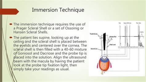 Image result for Biometry Procedure