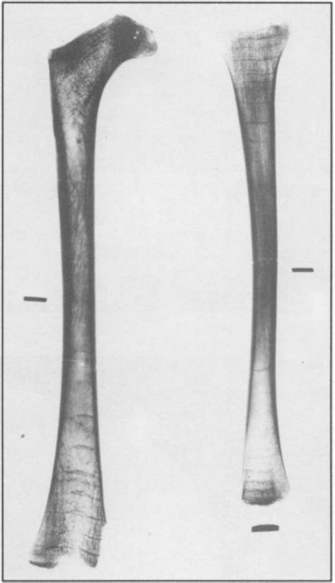 Image result for Transverse Line