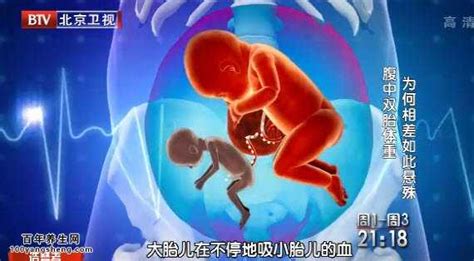 20150317生命缘视频和笔记:闫洪杰,双胎输血综合症,单绒双羊-生命缘-百年养生网