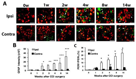 Deletion of Acid-Sensing Ion Channel 3 Relieves the Late Phase of ...