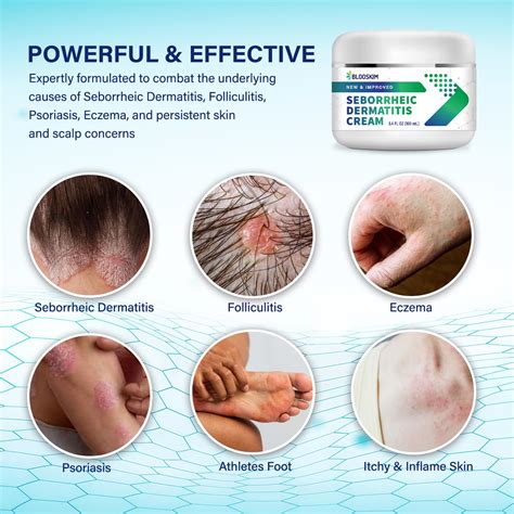 Seborrheic Dermatitis Cream,...B0BN7334VV | Encarguelo.com